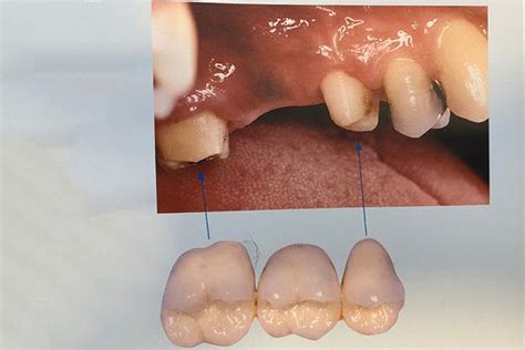 tandimplantat holbæk|Implantater & tandkirugi i Odsherred & Holbæk..